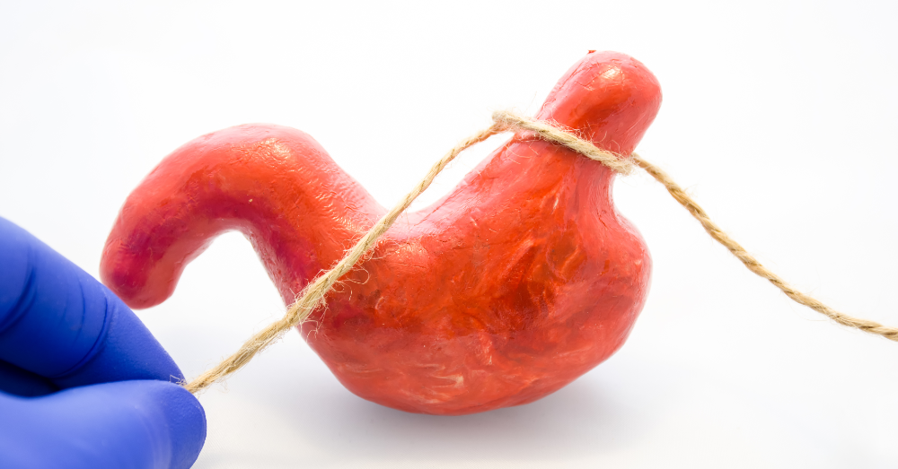 Should Bariatric Surgery be Your Weight Loss Solution?