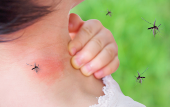 Why Some People Get Bitten By Mosquitoes More Than Others